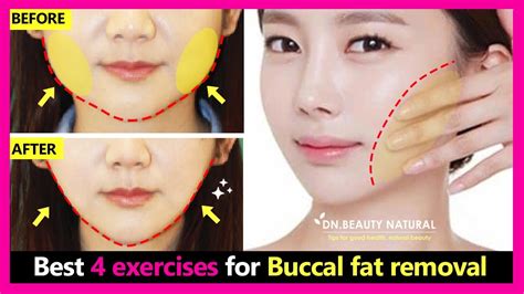 how to remove buccal fat naturally